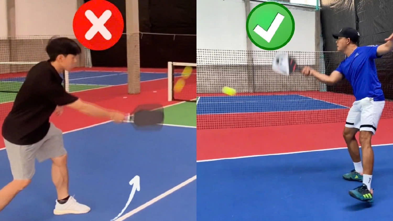 Những nguy&ecirc;n nh&acirc;n g&acirc;y chấn thương khi chơi pickleball